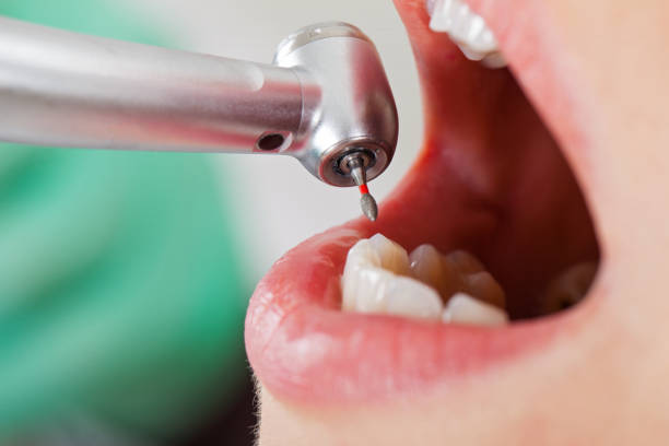 Best Dentist for Tooth Abscess  in Newark, DE